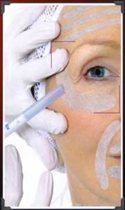 soin Botu-vip photo Ericson  Laboratoire