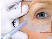 soin visage Botu-vip photo Ericson Laboratoire